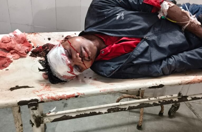 दो बाइकों की सीधी भिड़ंत में तीन लोग घायल, एक की हालत नाजुक